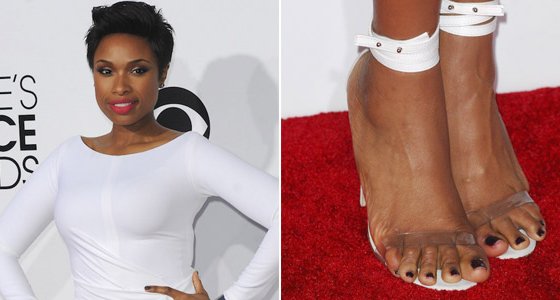 Famous Women Caught With Busted Up Feet [Photos] | The Latest Hip-Hop ...