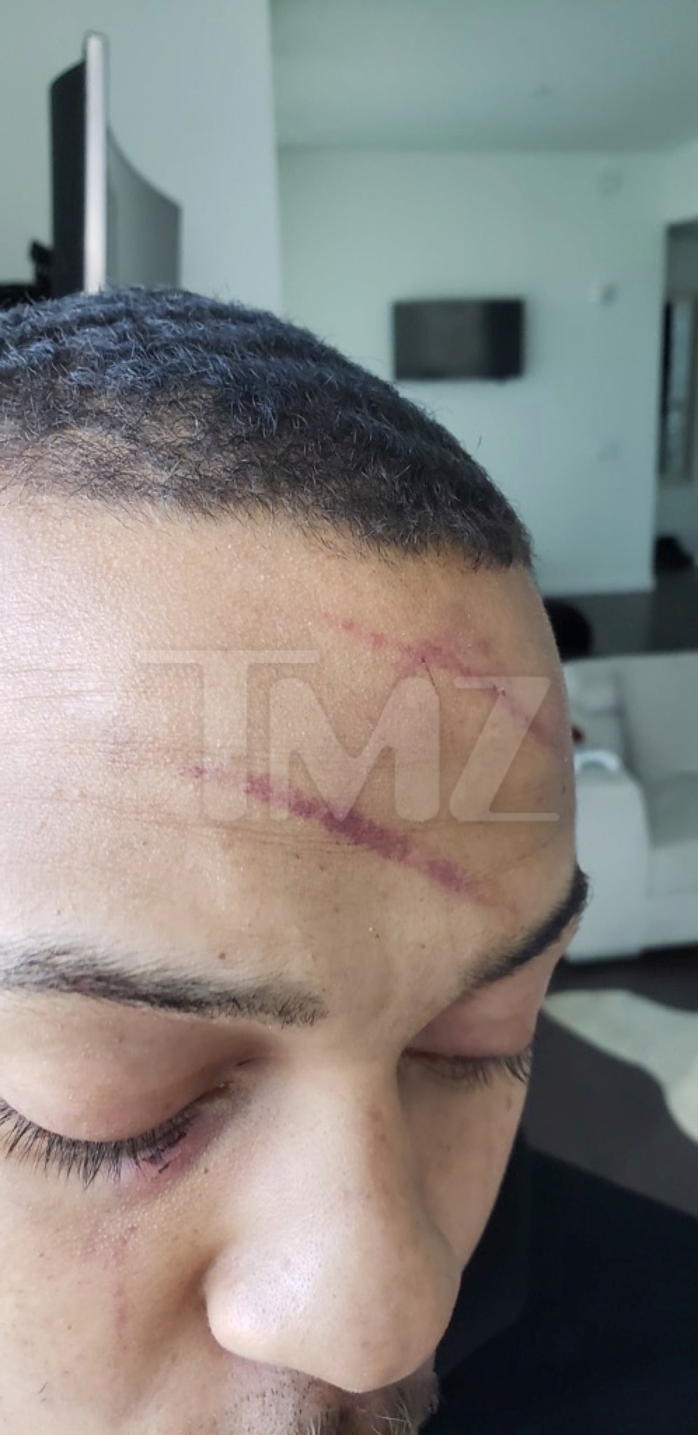 Bow Wow Domestic Violence Injuries