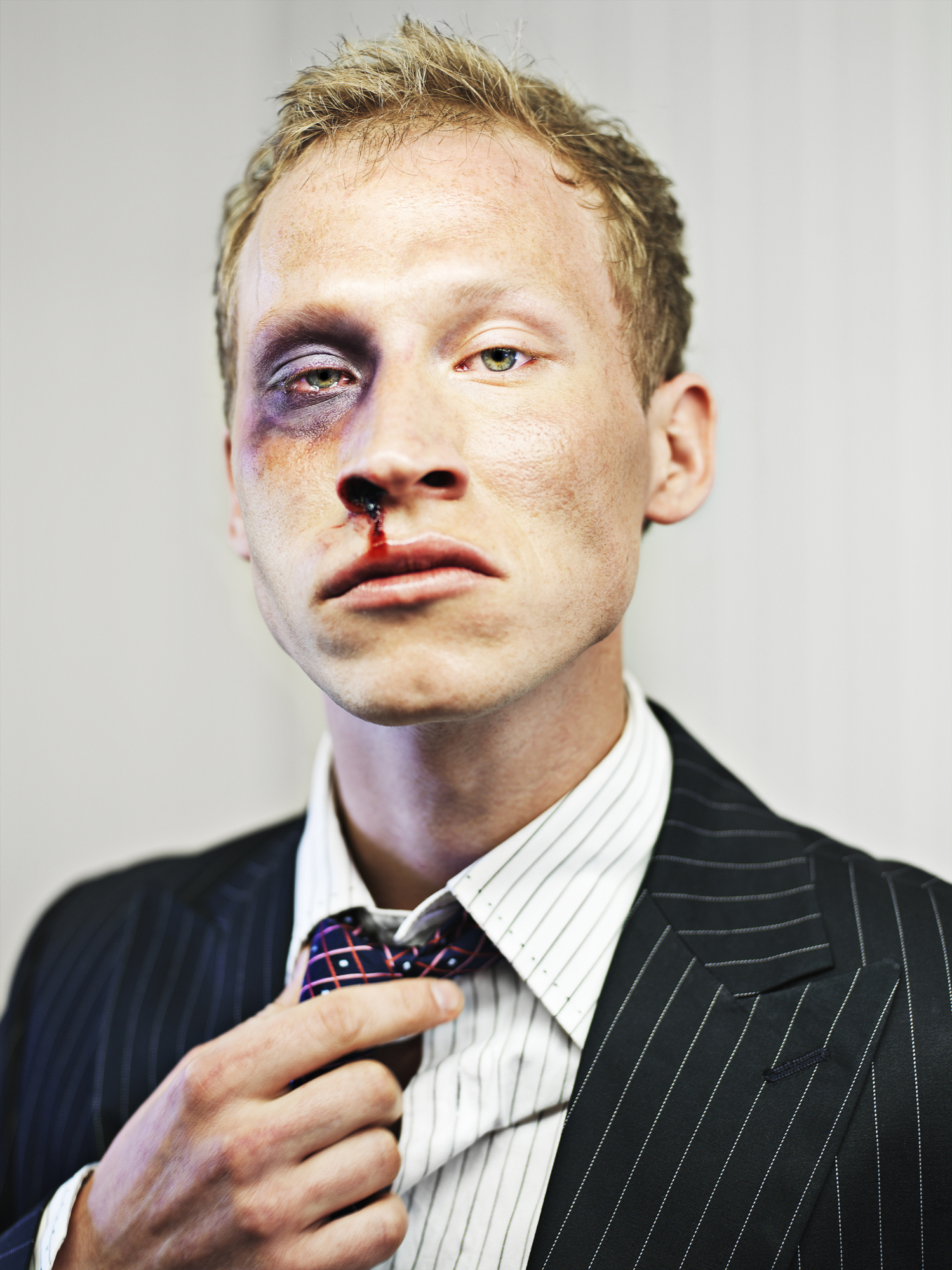 Stock market broker after a beating