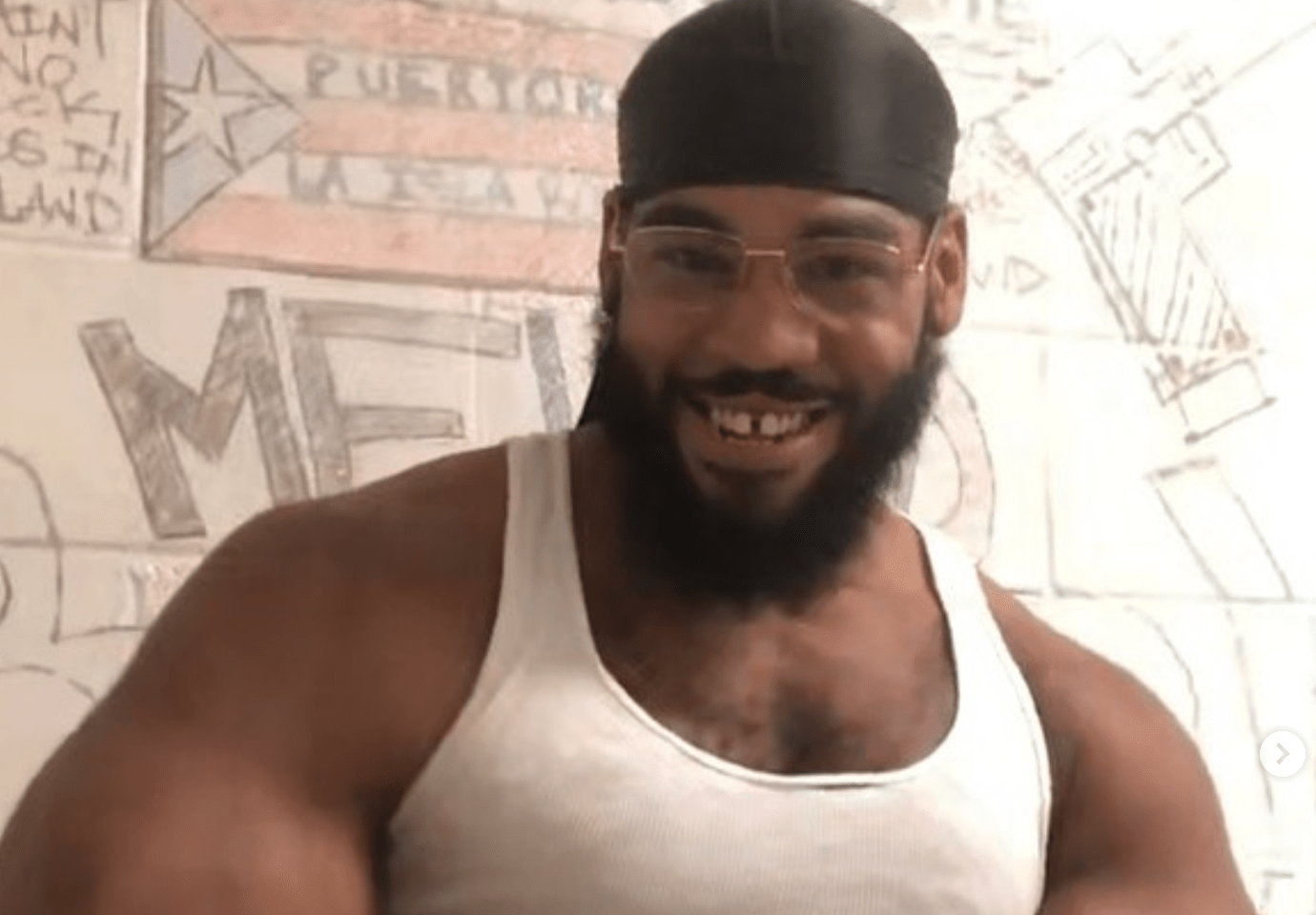 YM Bape aka Anthony Lopez